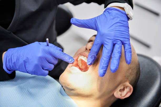 Best Emergency Treatment for Dental Infections or Abscesses in Castle Rock, CO